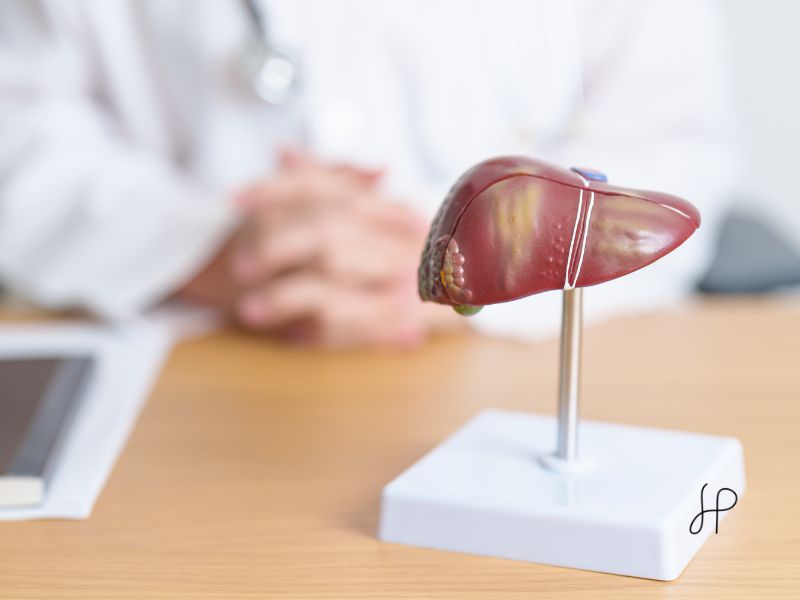 Esteatose Hepatica Causas Sintomas e Tratamentos para Gordura no Figado