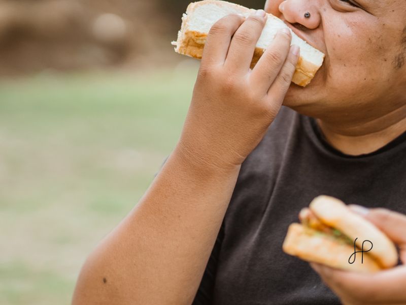 Tratamento da Obesidade com Topiramato